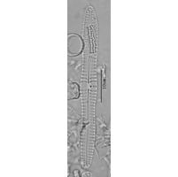Gompohonema lagerheimii