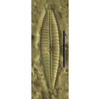 Gomphonema parvulum