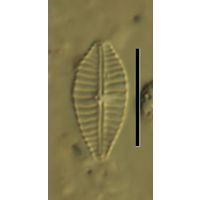 Gomphonema parvulum