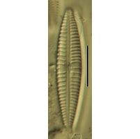 Gomphonema parvulum