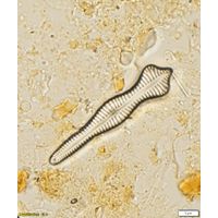 Gomphonema coronatum