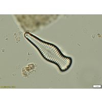 Gomphonema capitatum