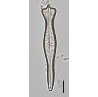 Gomphonema coronatum