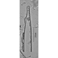 Hantzschia