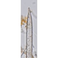 Hantzschia spectabilis