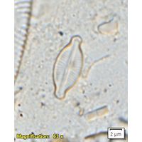 Karayevia laterostrata