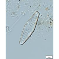 Luticola acidoclinata