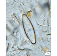 Luticola suecorum