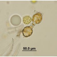 Melosira varians
