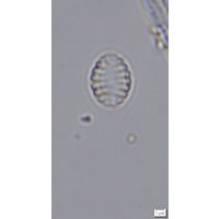 Nanofrustulum cataractarum