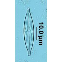 Navicula capitatoradiata