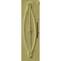 Navicula capitatoradiata