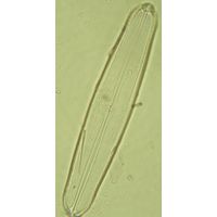 Neidium ampliatum