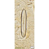 Neidium alpinum