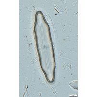 Neidium ampliatum