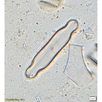 Neidium longiceps
