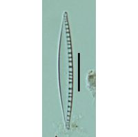 Nitzschia sociabilis