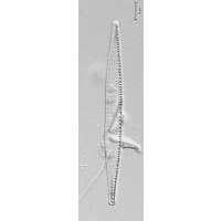 Nitzschia capitellata