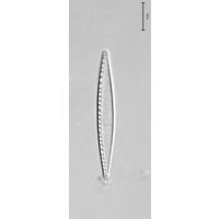 Nitzschia cf. liebertruthii