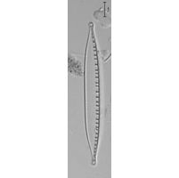 Nitzschia