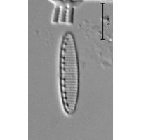 Nitzschia