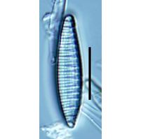 Nitzschia amphibioides