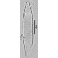 Nitzschia angustata
