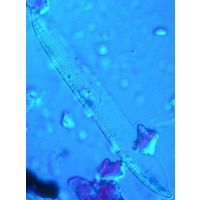 Nitzschia dubia