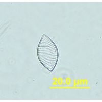 Nitzschia separanda