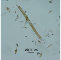 Nitzschia sigmoidea