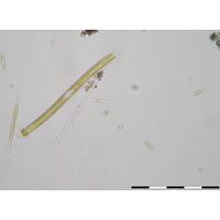 Nitzschia sigmoidea