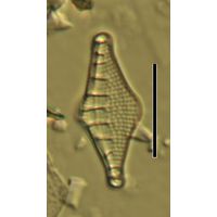 Nitzschia sinuata