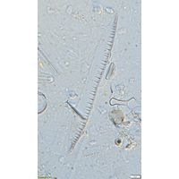 Nitzschia bremensis