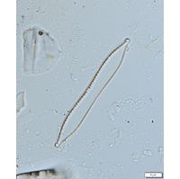 Nitzschia capitellata