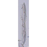 Nitzschia kittlii