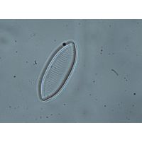 Nitzschia tryblionella