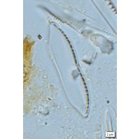 Nitzschia umbonata