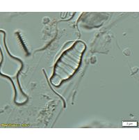 Odontidium anceps