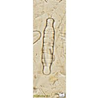 Odontidium anceps