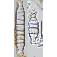 Odontidium anceps