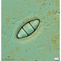 Odontidium mesodon