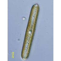 Pinnularia