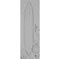 Pinnularia acuminata