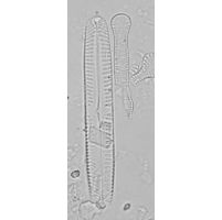 Pinnularia