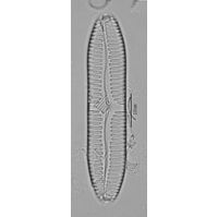 Pinnularia complexa