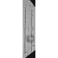 Pinnularia crucifera