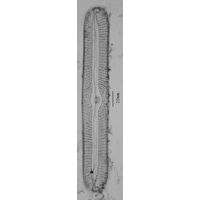 Pinnularia nobilis