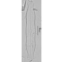 Pinnularia nodosa