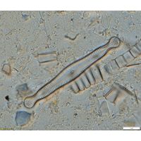 Pinnularia polyonca
