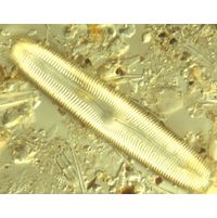 Pinnularia